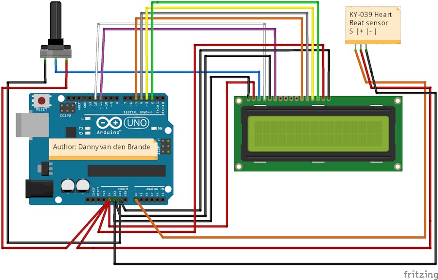 Arduino Simple Heart Beat Monitor With Lcd1602a Arduino Project Hub 1586